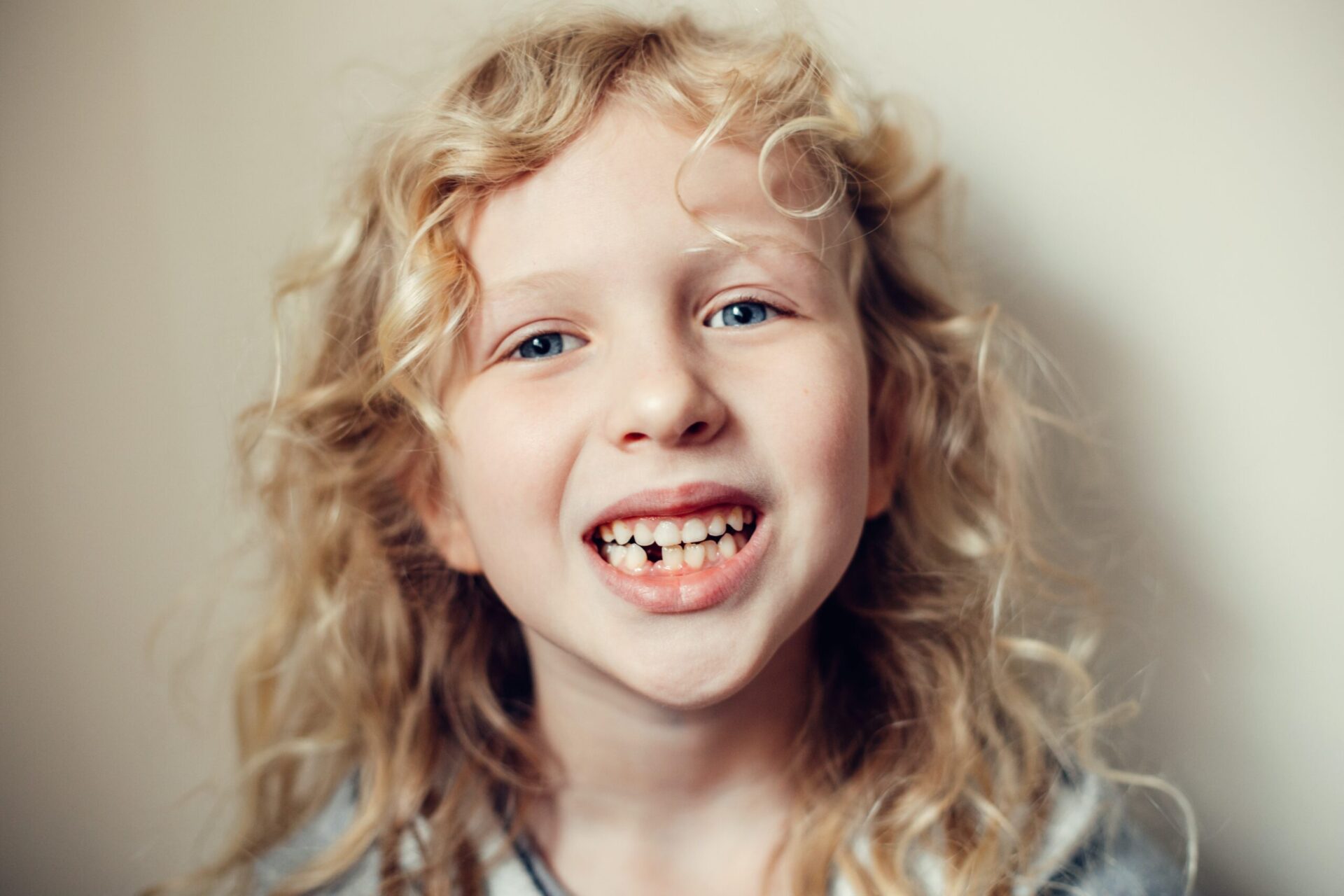 Missing Teeth